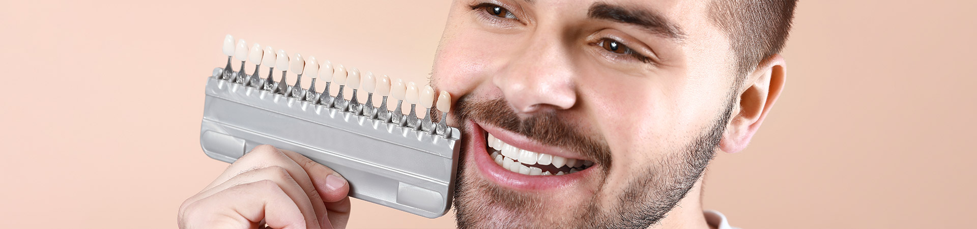 Zahnveneers